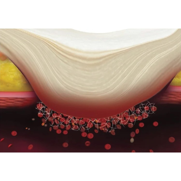 kontrola krwawienia.jpg